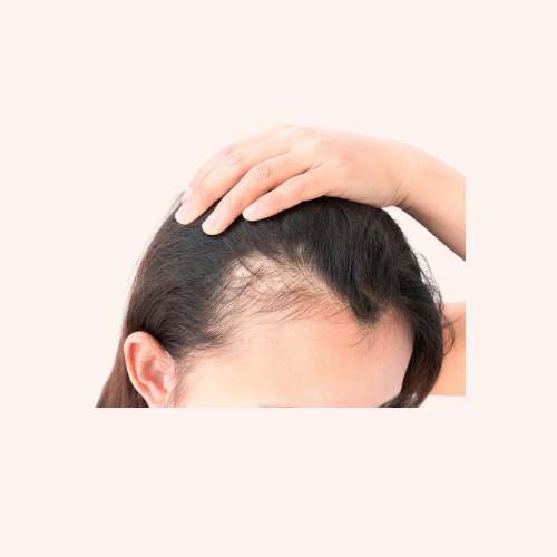 HAIR & SCALP CONCERNS