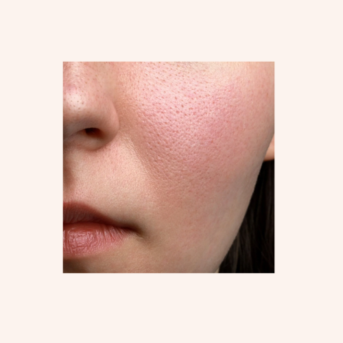 PORE MINIMIZING