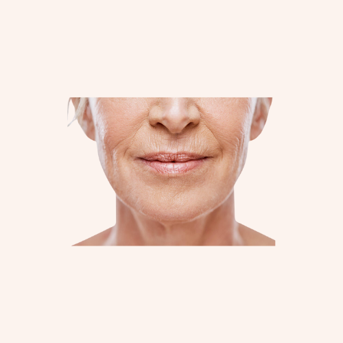 ANTI-AGING & WRINKLES